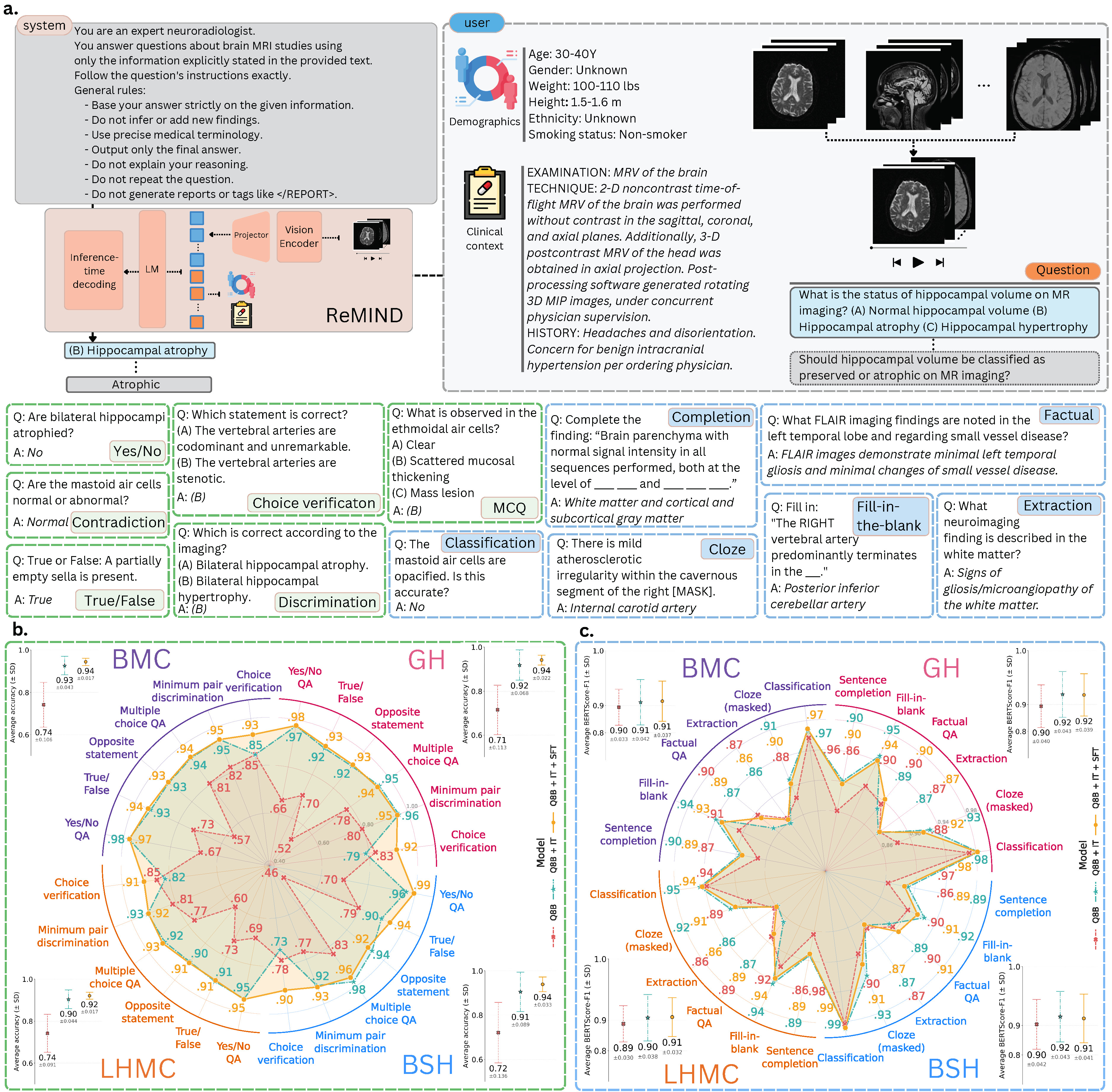 Brain MRI VLM Instruction Tuning